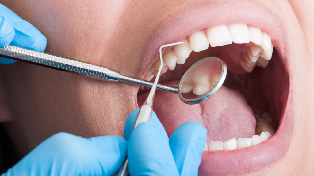 mouth being cleaned with dental tools